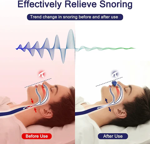 Tragbares Mikro-CPAP-Gerät gegen Schnarchen