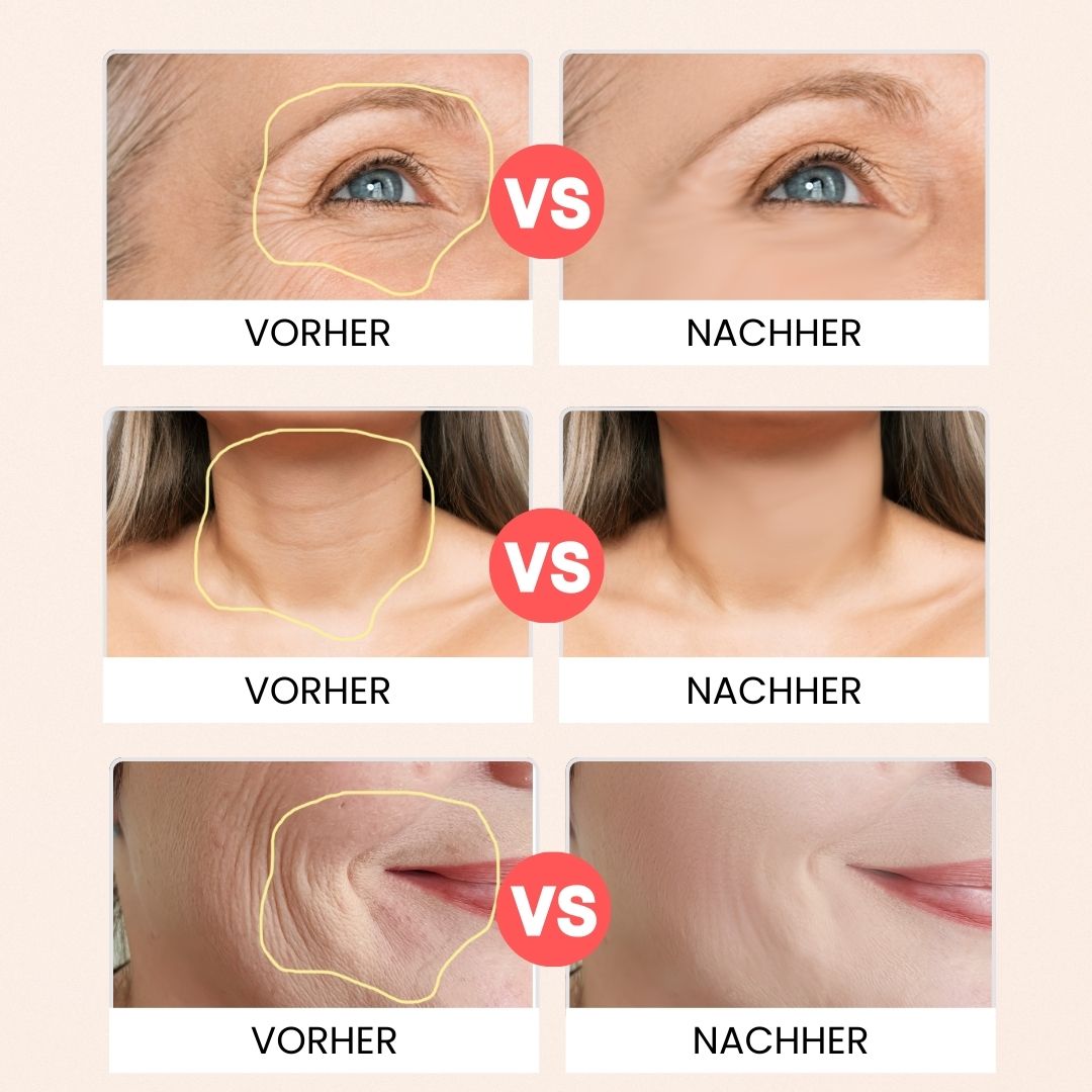 5-in-1 Lifting-Gerät für Gesicht und Hals