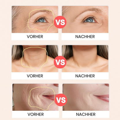 5-in-1 Lifting-Gerät für Gesicht und Hals